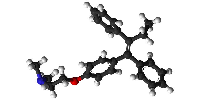 Tamoxifen a jeho analoga snižují incidenci karcinomu prsu u nejrizikovějších žen více než o třetinu